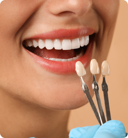 How Do Dental Veneers Work?